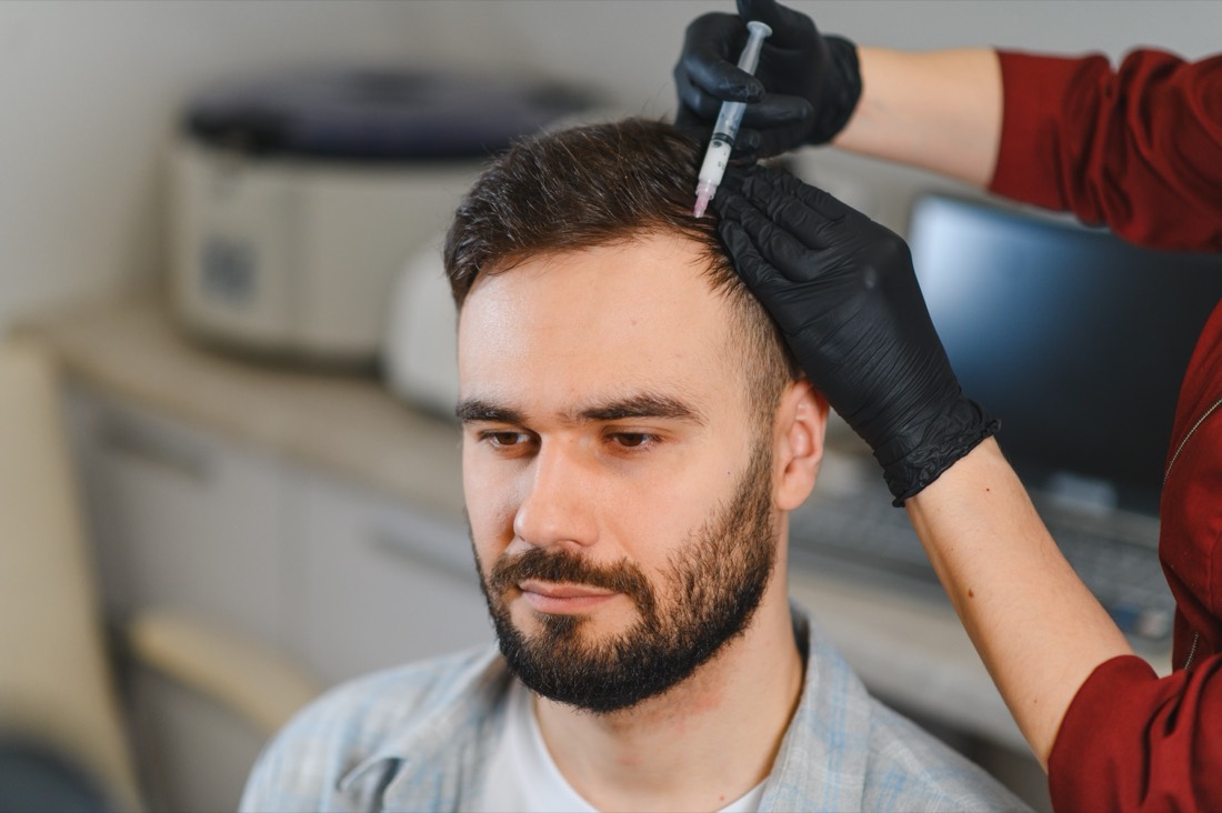 Tratamiento médico contra la alopecia y caída del cabello